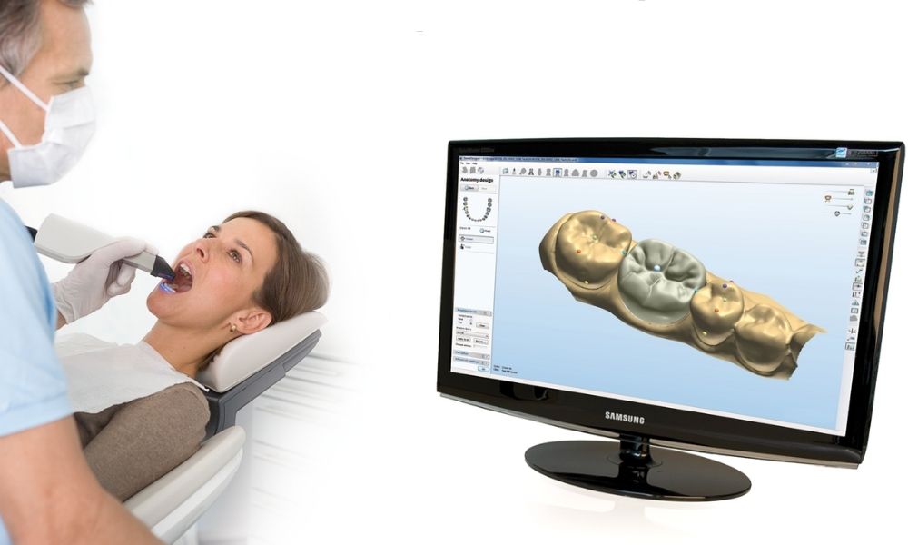 Dijital Diş Ölçüsü