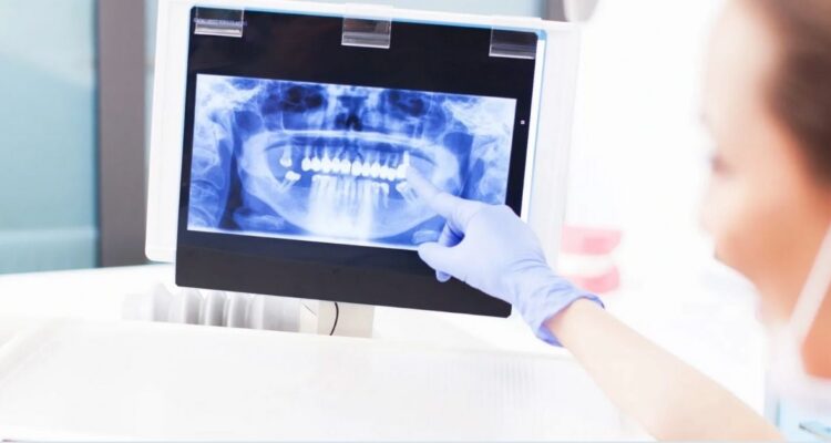 Dijital Diş Ölçüsü