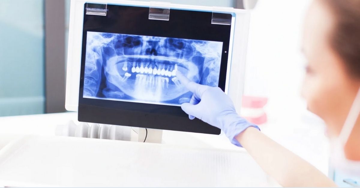 Dijital Diş Ölçüsü