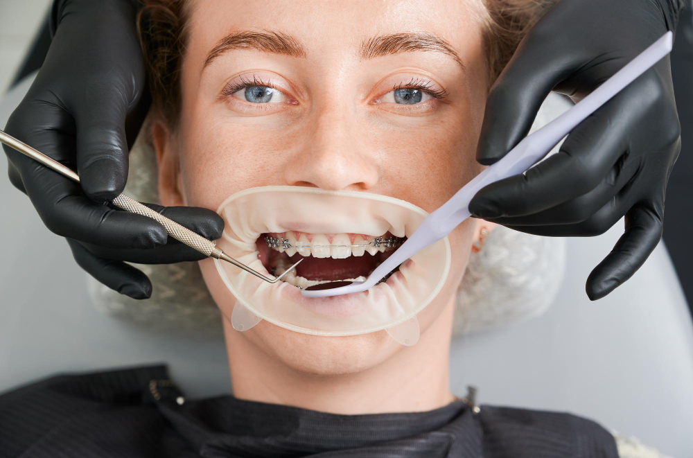 Çapraşık Diş Nasıl Olur